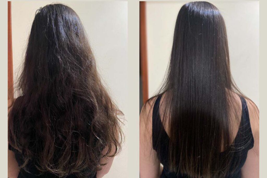 Resultados de Elizângela, antes e depois da aplicação do Hidraliso — Foto: Carla